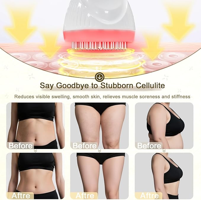 2025 Upgraded Lymphatic Drainage Massager Body Sculpting Machine Helps Reduce Stretch Marks & Cellulite for Legs, Arms & Belly Anti Cellulite Massage Tool with Light Heat & Vibration