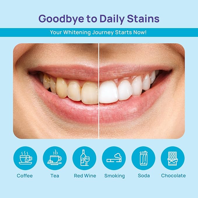 WhiteBite Pro Teeth Whitening Pens for Sensitive Teeth – 4 Pens Total (1 Blue Gel Pen for Sensitivity Relief), 35% Carbamide Peroxide Gel, Fast Whitening Results, Enamel-Safe, Travel-Friendly