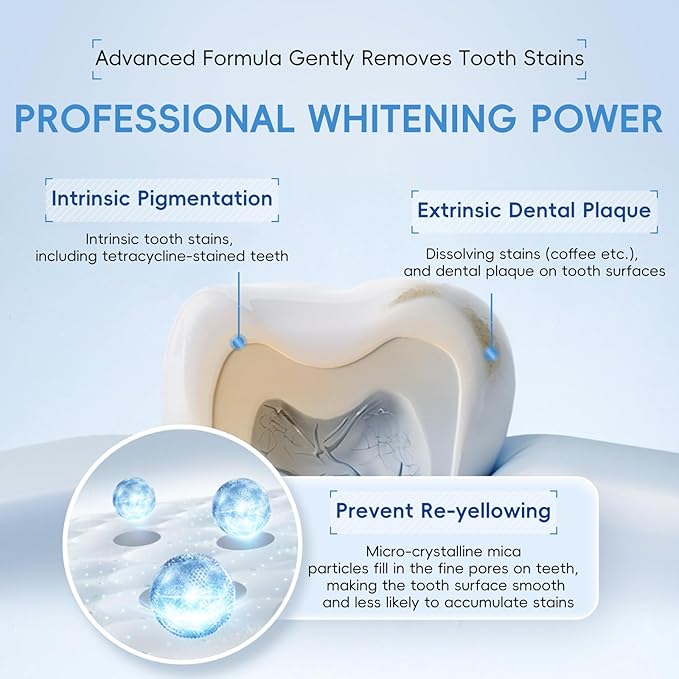 Teeth Whitening Gel- 30ml Formulated for Sensitive Teeth | Plus Food-Grade Silicone Mouth Tray | Dentist Developed
