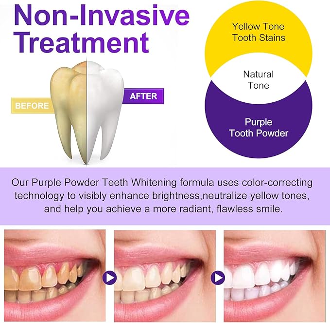 Teeth Whitening Powder - Teeth Whitening - Removes Stains - No Sensitivity - Toothpaste Power - Breath Freshener - for Coffee, Tea and Tobacco Stains 15g