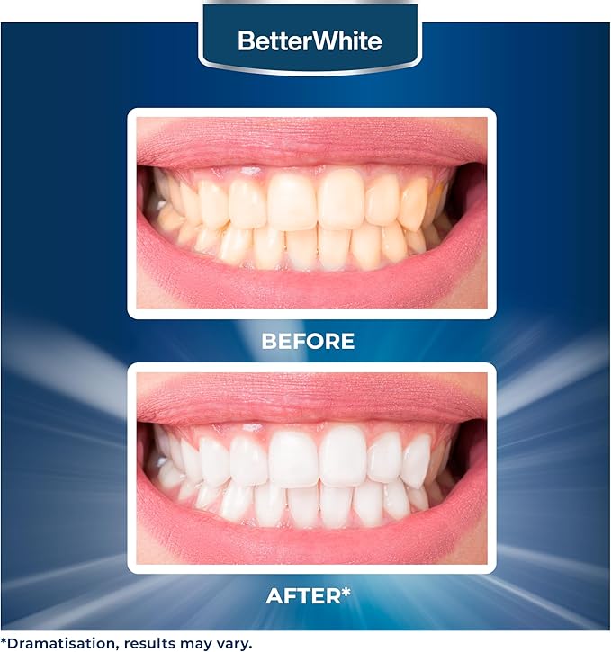 Teeth Whitening Powder - Hydroxyapatite, Remineralizing, Non-Sensitive Formula - Dentist-Approved Tooth Stain Remover & Polisher - Fluoride-Free (30 Grams)