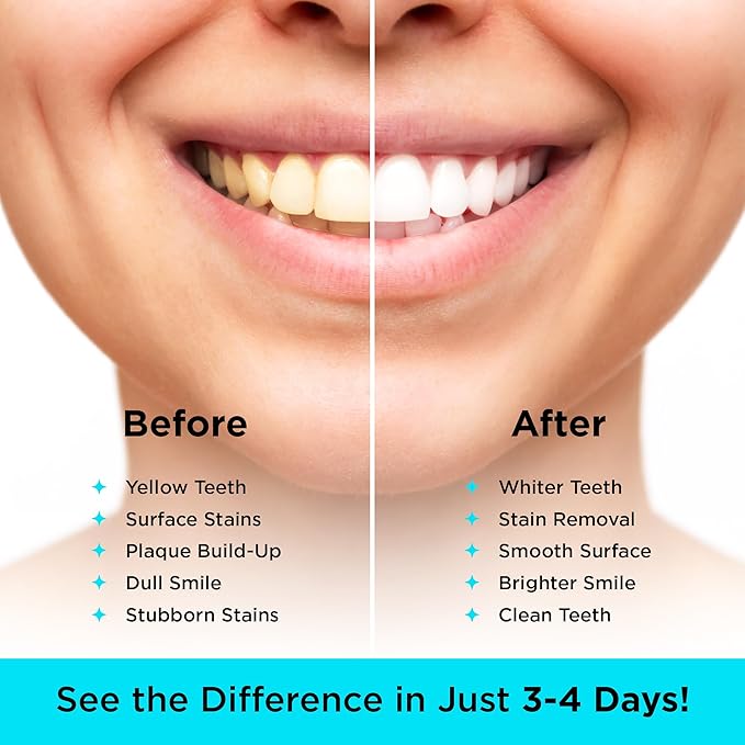 CARBON WHITE Teeth Whitening Powder - Natural Activated Coconut Charcoal Tooth Powder for Removing Stains & Discoloration - Helps Fight Tartar & Plaque, Freshens Breath - Tasteless, Odorless - 30g