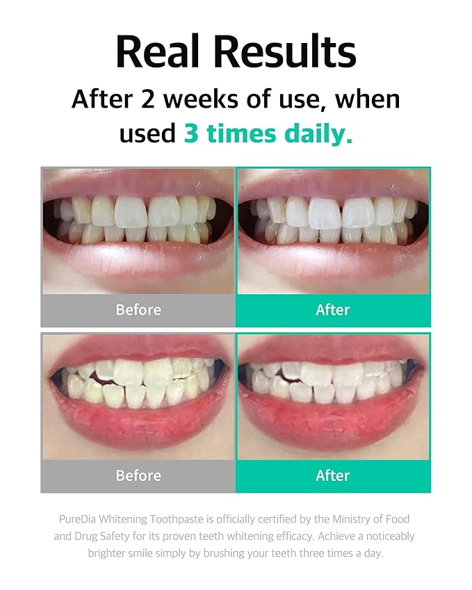 Live Orals Whitening Toothpaste 80g - Fluoride-Free Stain Removal, Strengthens Enamel, Natural Ingredients, Fresh Mint Flavor