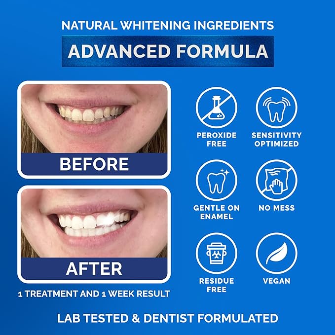 Whitening Strips for Sensitive Teeth 7 Treatments, Mint – Enamel Safe, Peroxide-Free Coconut Teeth Whitening Strips with Natural Enzymes – Gentle White Stips for Sensitive Gums & Daily Oral Care